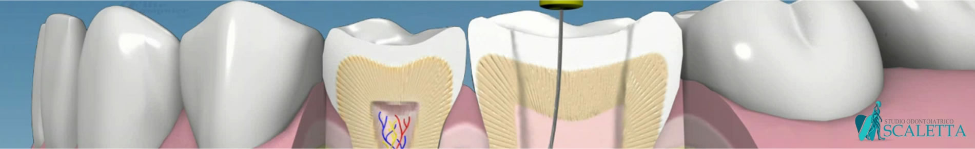 Endodonzia