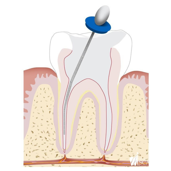 Endodonzia