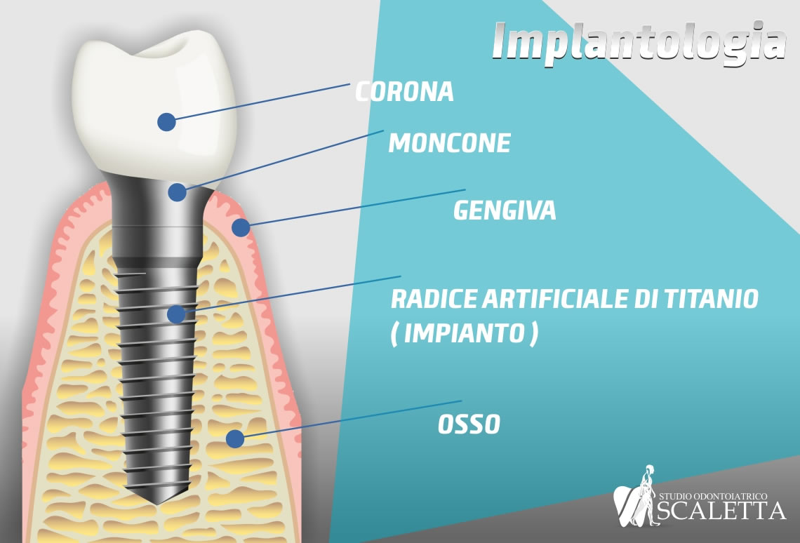 Studio odontoiatrico Dott.ssa Giusy Scaletta, Palermo e Termini Imerese