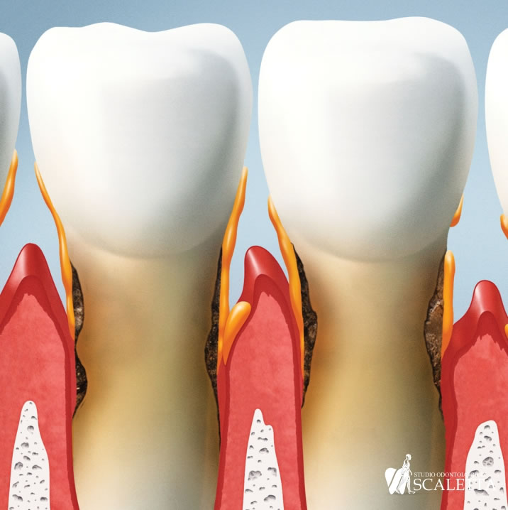 Parodontologia